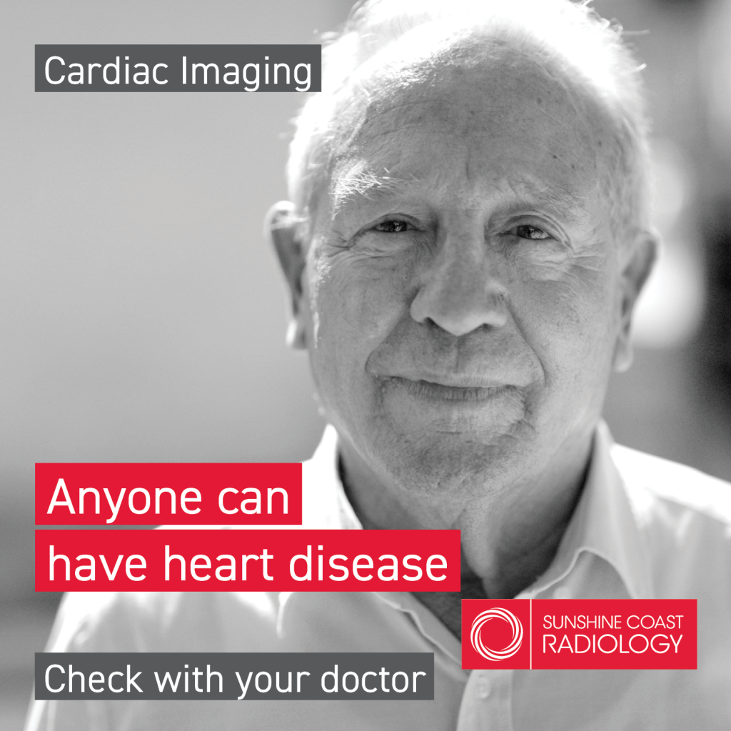 Cardiac Imaging Sunshine Coast Radiology Cardiac imaging sunshine coast radiology