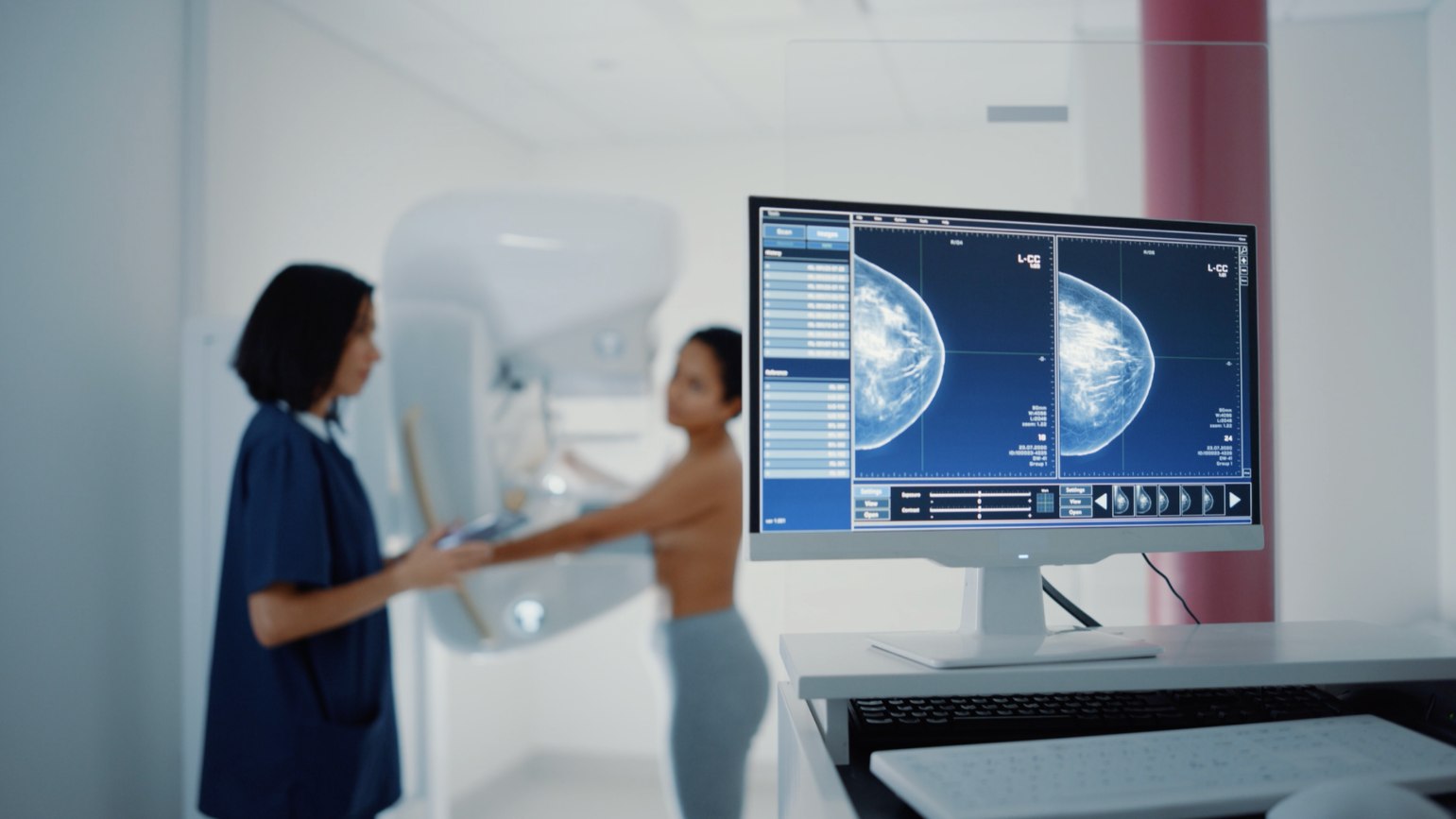 Breast Imaging Sunshine Coast | Specialist Women's Imaging